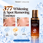 BIODURIC 377 Whitening & Spot Removing Essence | Dark Spot Care & Skin Brightening | 48ML