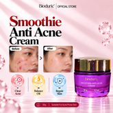 BIODURIC Smoothie Anti-Acne Cream | Acne Care & Oil Control | 50G