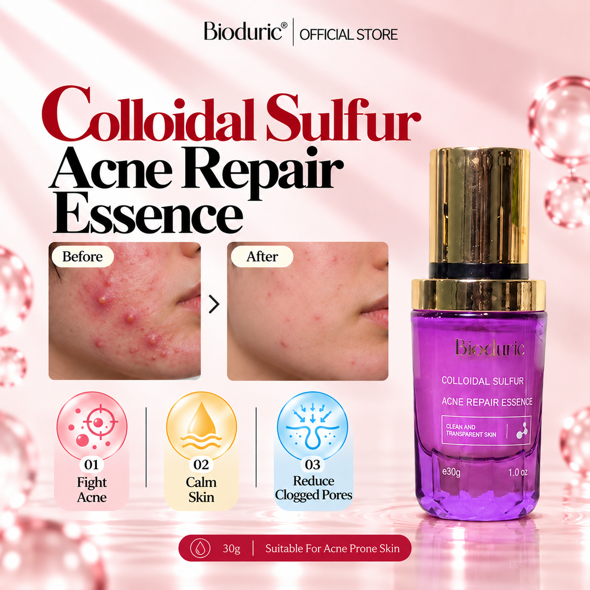BIODURIC Colloidal Sulfur Acne Repair Essence | Acne Care & Pore Clarifying | 30G