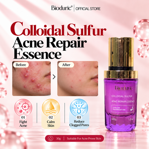 BIODURIC Colloidal Sulfur Acne Repair Essence | Acne Care & Pore Clarifying | 30G